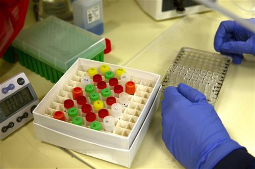 antibody testing 